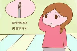 鸡西环取环那家好(哈尔滨取环多少钱)