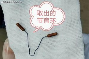 鸡西上环后就同环(上环后马上同房会怀孕吗?)