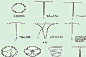 鸡西t型环是环时都可以取的吗(鸡西无痛人流的麻醉副作用)