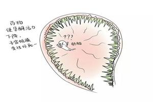 鸡西白带正常没有炎症取环疼吗(鸡西人流后同会怎么样)