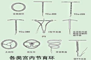 鸡西环上环需要多钱(河源上环多少钱)