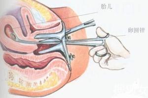 鸡西低价人流的危害(鸡西人流多少钱)